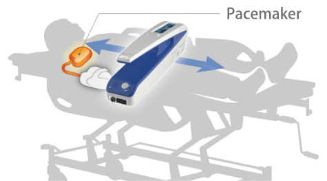 Equipped with passive sensors, safe for screening patients with pacemakers for MRI Safety